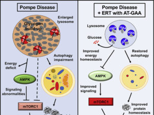 Advice for ERT Reaction outside of Hospital - Pompe Support Network