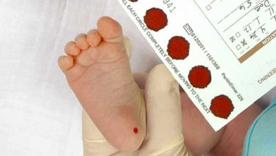 Next Generation Sequencing using Dried Bloodspot